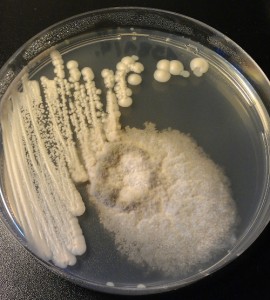 Mold contamination of yeast colony. Photo Source: https://eurekabrewing.wordpress.com/2012/08/24/yeast-banking-2-agar-plates/