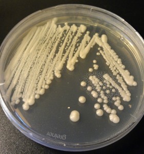 Healthy yeast culture colony on an agar plate. Photo Source: https://eurekabrewing.wordpress.com/2012/08/24/yeast-banking-2-agar-plates/